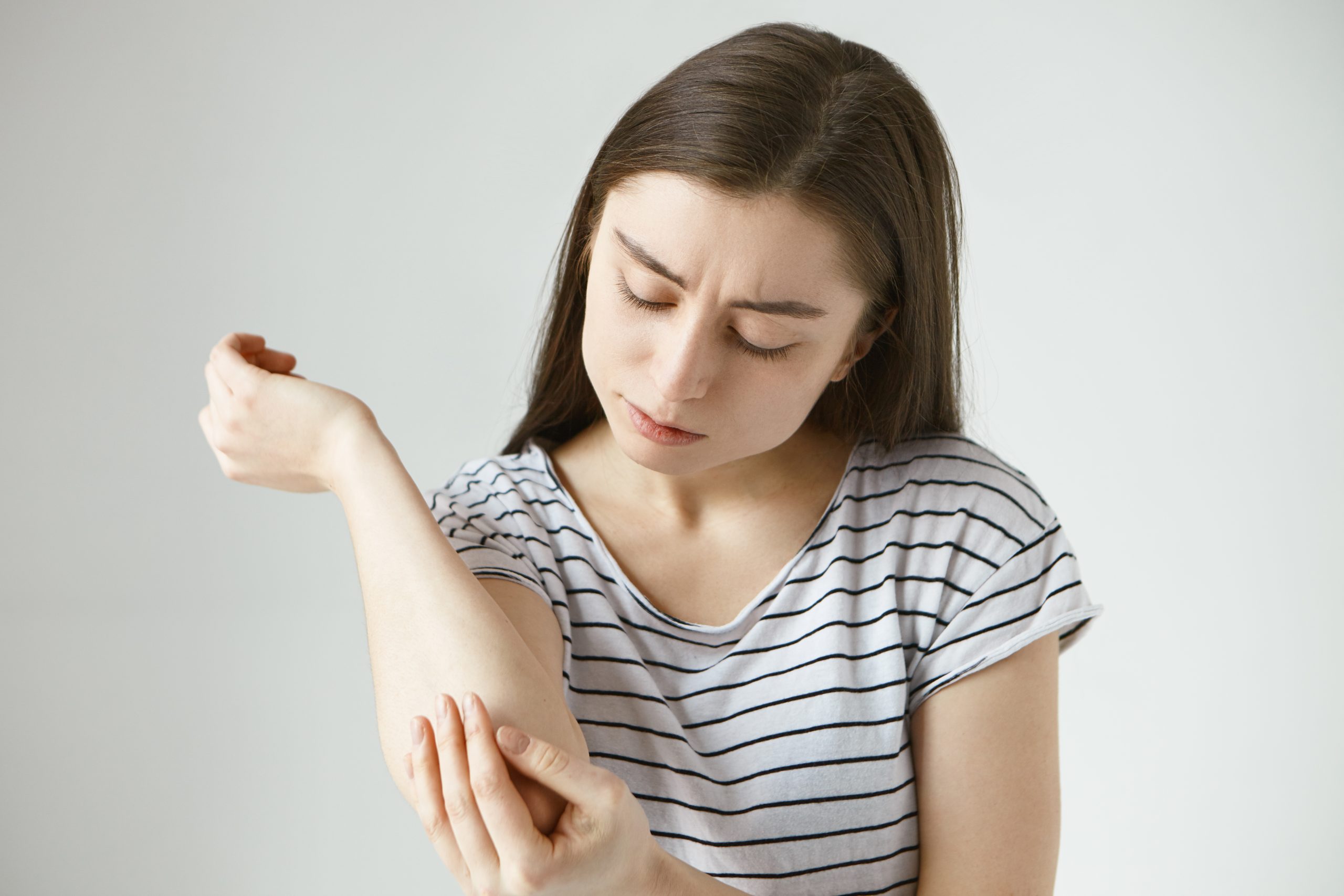 Síntomas y lesiones de la dermatitis atópica